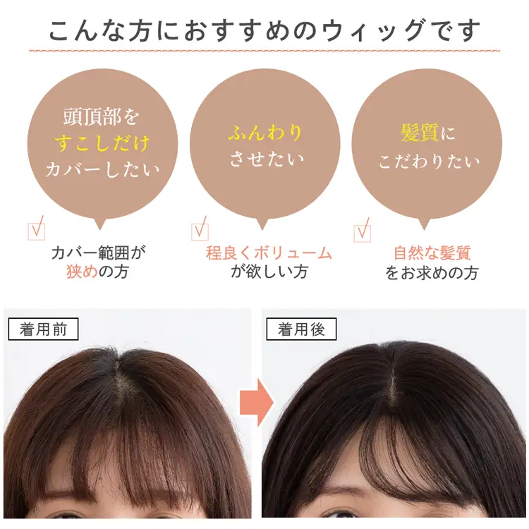 総手植え 最高級人毛(レミー)100％ コンパクト トップヘアピース メイン2