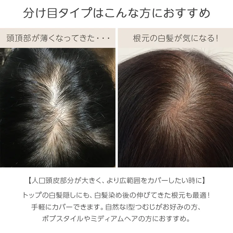人毛100% マシンメイドトップヘアピース 分け目タイプ メイン16