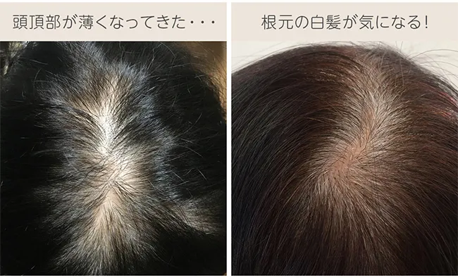 マシンメイド人毛100%トップヘアピース 分け目タイプ hp004 商品詳細15