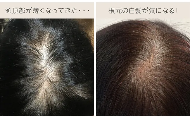 最高級人毛100%トップヘアピース ハイカバータイプ hp104商品詳細17